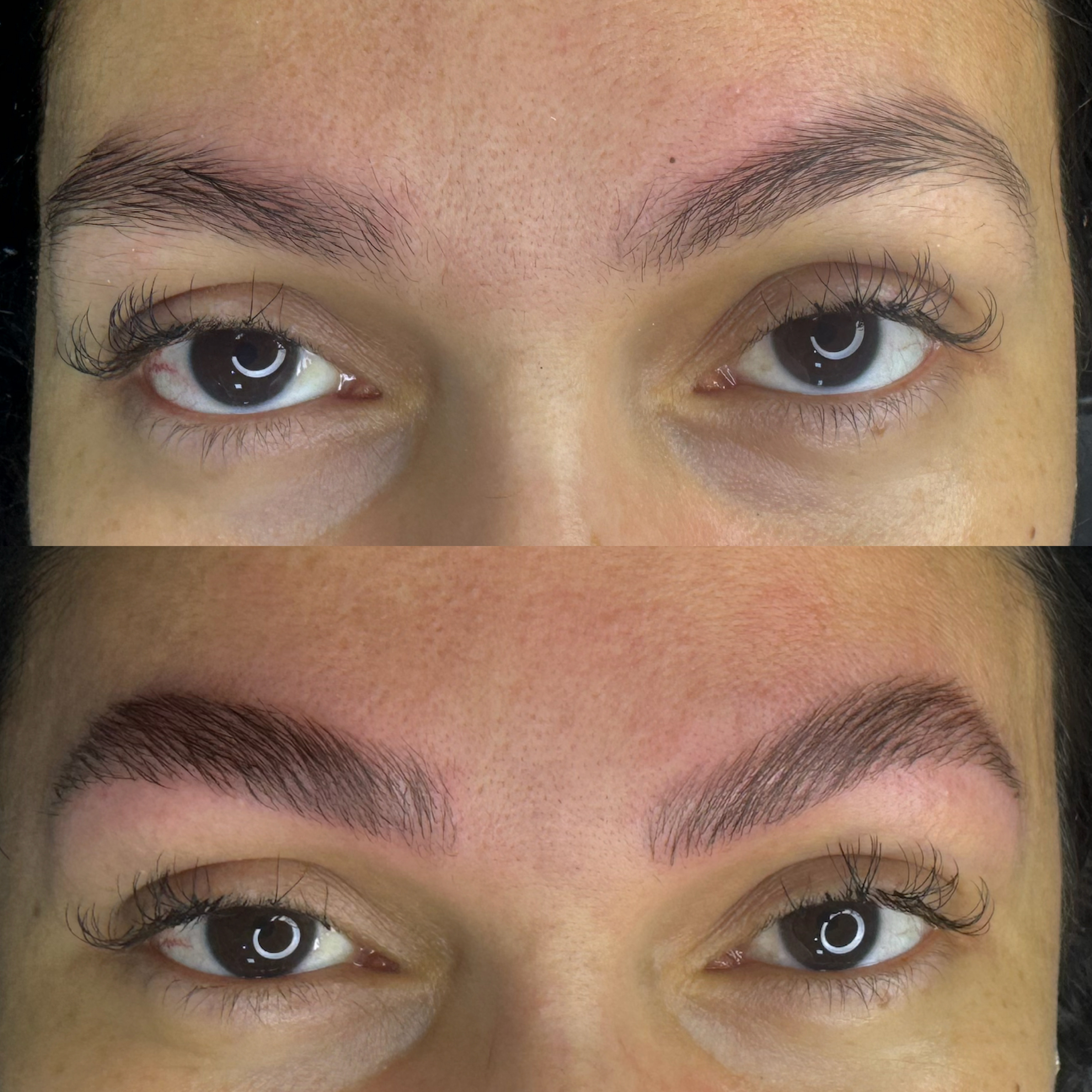 Resultado de tratamento - Antes e Depois